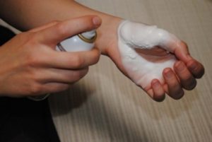 Способы чем обработать ожог в домашних условиях
